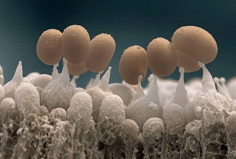 ciuperca unghiei de la picioare la microscop