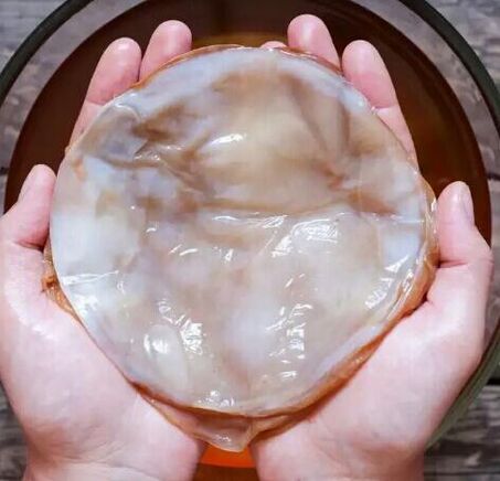 ciuperca unghiilor kombucha